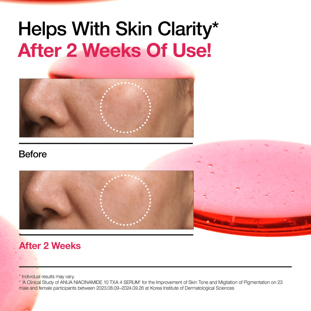ANUA Niacinamide 10% + TXA 4% Dark Spot Correcting Serum