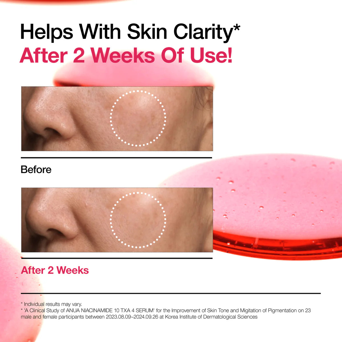 ANUA Niacinamide 10% + TXA 4% Dark Spot Correcting Serum