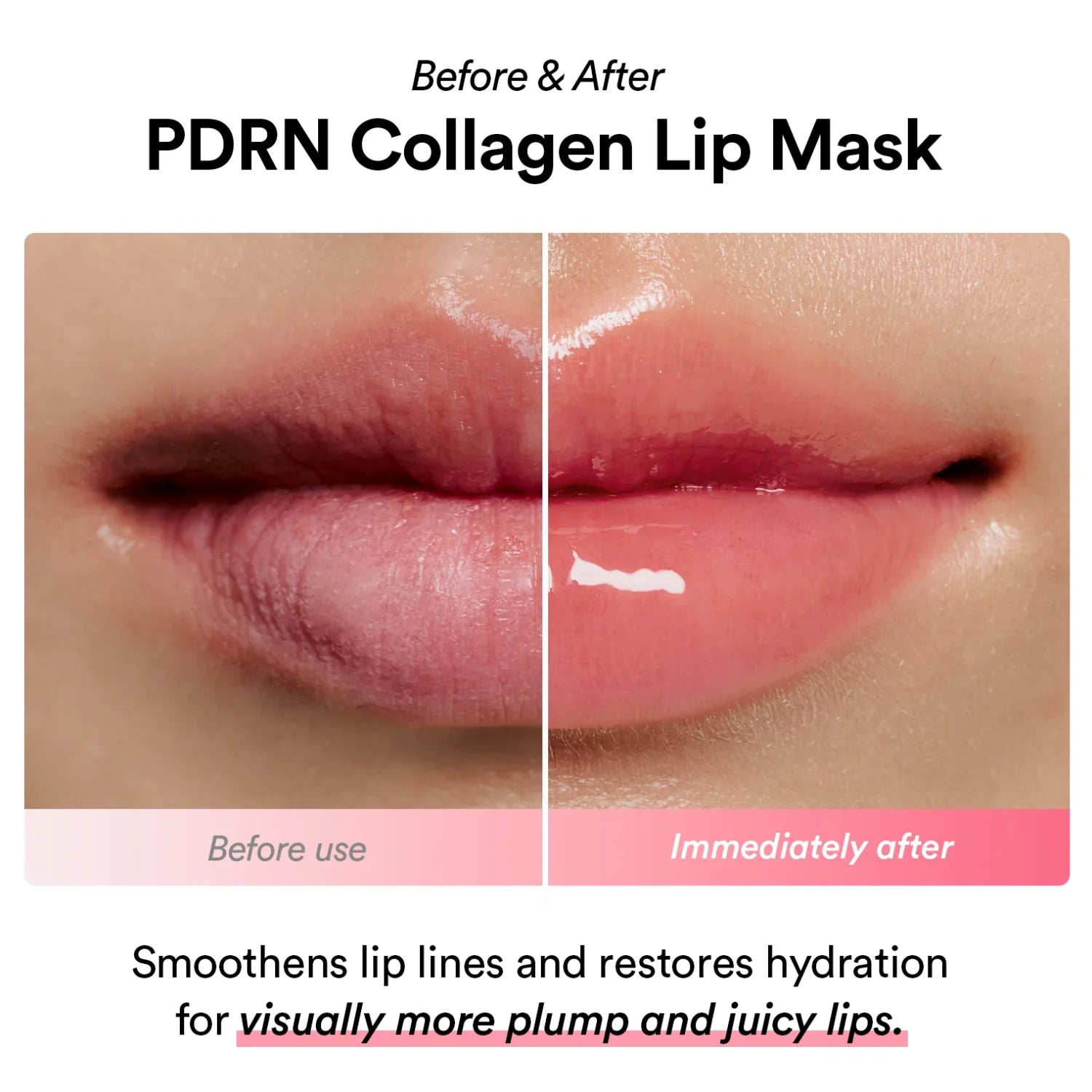 ABIB PDRN collagen lip mask Glazed jelly (11g)