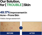 MEDIHEAL Teatree Trouble Pad (100pcs)