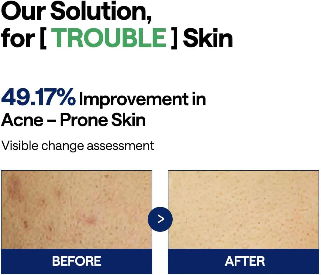 MEDIHEAL Teatree Trouble Pad (100pcs)