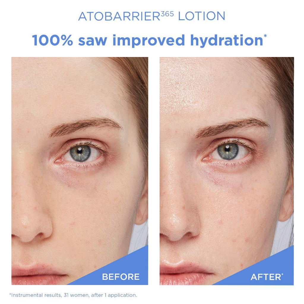 AESTURA Atobarrier 365 Lotion (150ml)