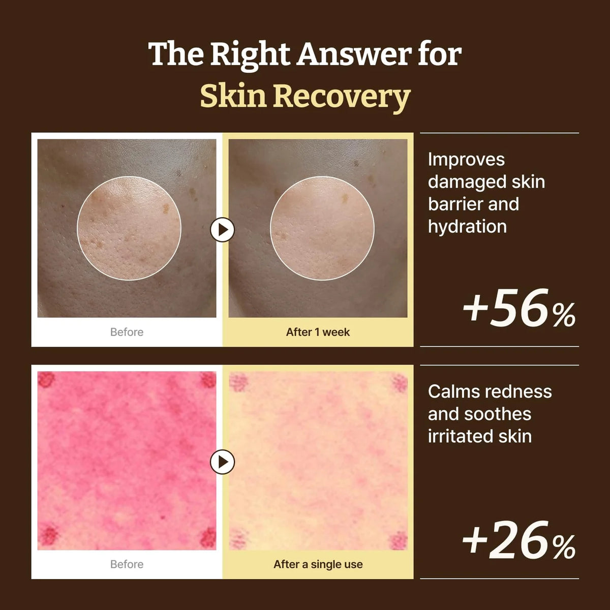 Dr. Reju-All Advanced PDRN Rejuvenating Cream (20g)