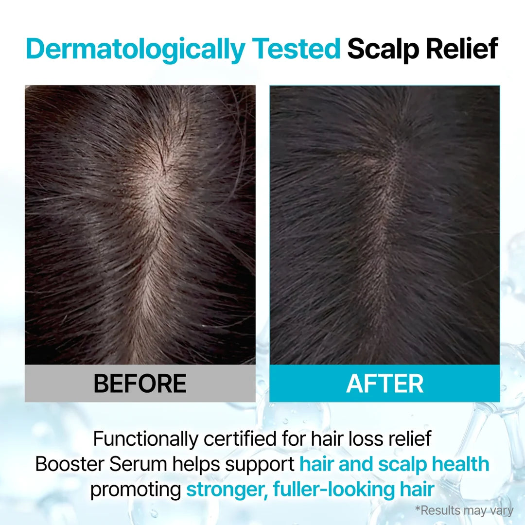 GROWUS Recover Therapy Hair Booster Serum (15ml)