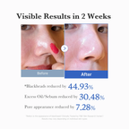 Medicube Zero Pore Pads 2.0