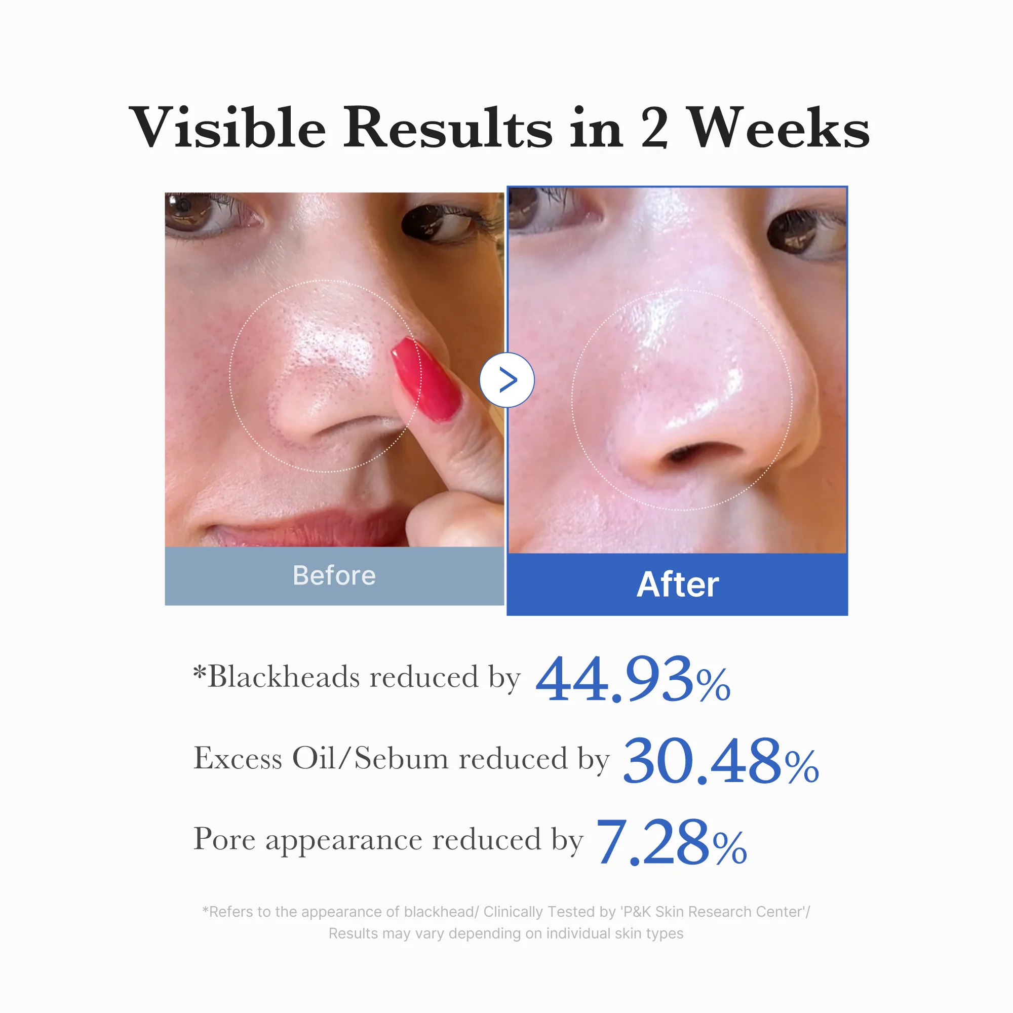 Medicube Zero Pore Pads 2.0