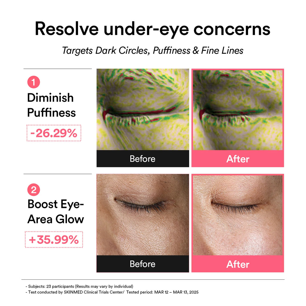 Abib PDRN retinal eye patch Glow jelly (84g)