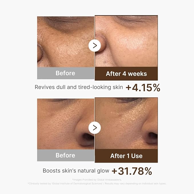 MEDICUBE Deep Vita C Capsule Serum (30ml)