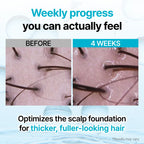 GROWUS Recover Therapy Hair Booster Serum (15ml)