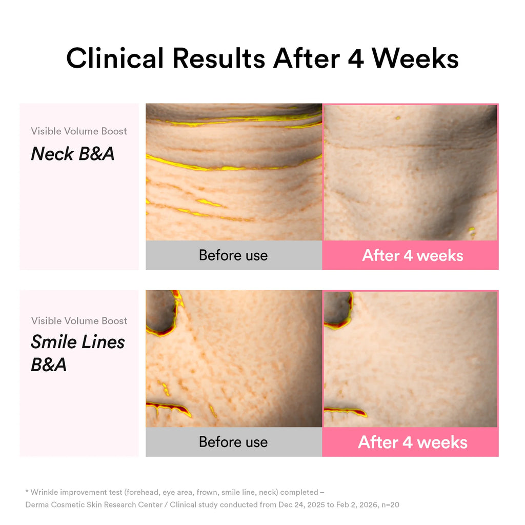 ABIB PDRN Volume Fill-It Booster 2.5 Tube (30ml)